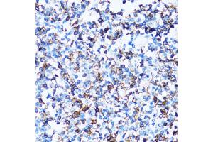 Immunohistochemistry of paraffin-embedded human tonsil using SPN antibody (ABIN2560118) at dilution of 1:100 (40x lens). (CD43 anticorps)