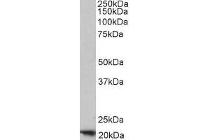 ABIN334401 (1µg/ml) staining of Human Placenta lysate (35µg protein in RIPA buffer). (FTH1 anticorps  (C-Term))
