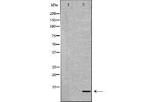 Western blot analysis of extracts of K-562, using S100A8 antibody. (S100A8 anticorps  (C-Term))
