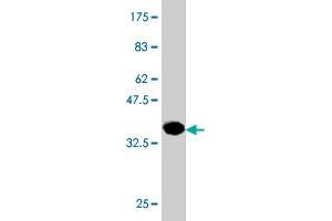 Western Blot detection against Immunogen (36. (PHOSPHO1 anticorps  (AA 168-266))