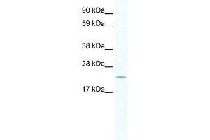 Human Placenta; WB Suggested Anti-SERTAD1 Antibody. (SERTAD1 anticorps  (N-Term))