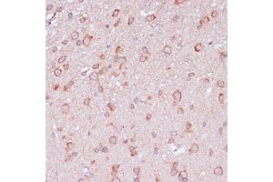 Immunohistochemistry of paraffin-embedded rat brain using RPL32 antibody (ABIN6129104, ABIN6147138, ABIN6147139 and ABIN6216824) at dilution of 1:100 (40x lens). (RPL32 anticorps  (AA 1-135))