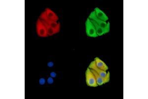 ABIN7096150 and ABIN7100212 staining Hela cells by IF/ICC.