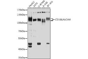 Western blot analysis of extracts of various cell lines, using CD166/CD166/ALCAM antibody (ABIN6127405, ABIN6136759, ABIN6136760 and ABIN6219454) at 1:1000 dilution. (CD166 anticorps  (AA 28-180))