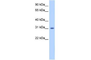 WB Suggested Anti-APOBEC2 Antibody Titration:  1. (APOBEC2 anticorps  (N-Term))