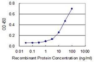 Detection limit for recombinant GST tagged DIP2A is 0. (DIP2A anticorps  (AA 107-301))