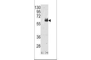 Western blot analysis of TAU(arrow) using rabbit polyclonal TAU Antibody (ABIN388782 and ABIN2839114). (tau anticorps  (C-Term))