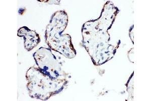 IHC-P: HSD17B1 antibody testing of human placenta tissue