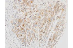 IHC-P Image Immunohistochemical analysis of paraffin-embedded A549 xenograft, using VPS26, antibody at 1:500 dilution.