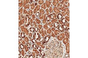 Immunohistochemical analysis of paraffin-embedded human kidney tissue using (ABIN657909 and ABIN2846858) performed on the Leica® BOND RXm. (TRPV1 anticorps  (N-Term))