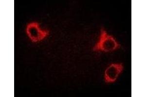 Immunofluorescent analysis of GCN2 staining in HepG2 cells. (GCN2 anticorps)