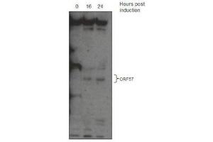 Western Blotting (WB) image for anti-KSHV ORF57 antibody (ABIN2995166) (KSHV ORF57 anticorps)