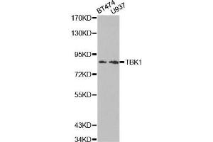 Western blot analysis of extracts of various cell lines, using TBK1 antibody. (TBK1 anticorps  (AA 440-729))