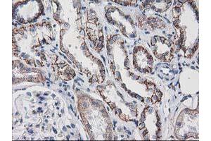 Image no. 3 for anti-Vascular Cell Adhesion Molecule 1 (VCAM1) antibody (ABIN1497155)