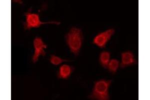 ABIN6275995 staining HepG2 by IF/ICC. (GPR137C anticorps  (Internal Region))