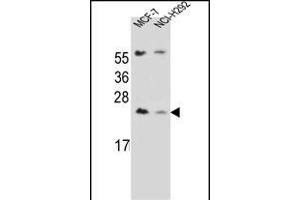 LIN7C Antibody (C-term) (ABIN656734 and ABIN2845958) western blot analysis in MCF-7,NCI- cell line lysates (35 μg/lane). (LIN7C anticorps  (C-Term))