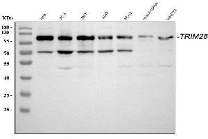 Western blot analysis of KAP1 using anti-KAP1 antibody (ABIN3043491). (KAP1 anticorps  (AA 699-835))