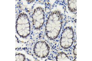 Immunohistochemistry of paraffin-embedded human colon using S Rabbit mAb (ABIN7270152) at dilution of 1:100 (40x lens). (SATB2 anticorps)