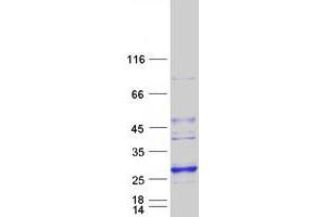 Lysophospholipase-Like Protein 1 (LYPLAL1) protein (Myc-DYKDDDDK Tag)