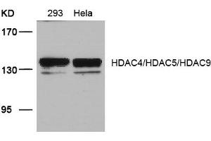 Western blot analysis of extracts from 293 and Hela cells using HDAC4/HDAC5/HDAC9(Ab-246/259/220) Antibody. (HDAC4/HDAC5/HDAC9 anticorps)