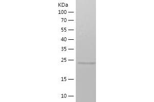 Western Blotting (WB) image for Methyltransferase Like 4 (METTL4) (AA 289-463) protein (His tag) (ABIN7123948) (METTL4 Protein (AA 289-463) (His tag))