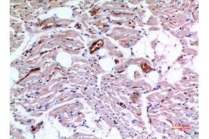 Immunohistochemistry (IHC) analysis of paraffin-embedded Human Heart, antibody was diluted at 1:100.