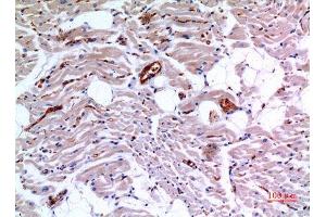 Immunohistochemistry (IHC) analysis of paraffin-embedded Human Heart, antibody was diluted at 1:100. (IDH3A anticorps  (Internal Region))