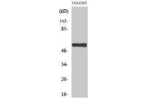 Western Blotting (WB) image for anti-Microphthalmia-Associated Transcription Factor (MITF) (Ser90) antibody (ABIN3180176) (MITF anticorps  (Ser90))