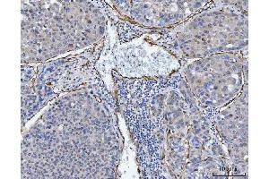 IHC analysis of TP53I13 using anti-TP53I13 antibody (ABIN7601220). (TP53I13 anticorps  (AA 30-365))