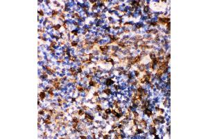 Anti-Caspase-6(P18) antibody,  IHC(P) IHC(P): Rat Spleen Tissue