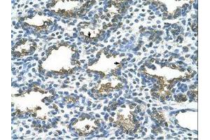 Image no. 1 for anti-Placental Alkaline Phosphatase (ALPP) (AA 411-460) antibody (ABIN203490)