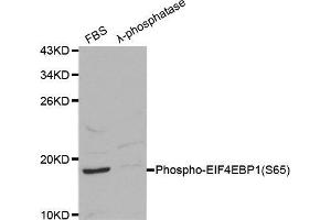 Western blot analysis on 293 cell lysates using Phospho-EIF4EBP1-S65 antibody. (eIF4EBP1 anticorps  (pSer65))