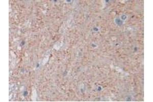 IHC-P analysis of Rat Spinal Cord Tissue, with DAB staining. (PTPRB anticorps  (AA 1041-1310))