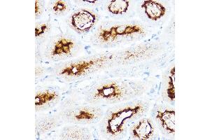Immunohistochemistry of paraffin-embedded mouse kidney using SLC3 Rabbit pAb (ABIN6132663, ABIN6147998, ABIN6147999 and ABIN6221169) at dilution of 1:200 (40x lens). (SLC3A1 anticorps  (AA 416-685))