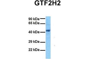 Host:  Rabbit  Target Name:  GTF2H2  Sample Tissue:  Human 293T  Antibody Dilution:  1. (GTF2H2 anticorps  (Middle Region))