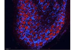 Image no. 1 for Rabbit anti-Mouse IgG antibody (Atto 550) (ABIN1102330) (Lapin anti-Souris IgG Anticorps (Atto 550))