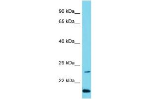 Host: Rabbit Target Name: C10orf95 Sample Type: Jurkat Whole Cell lysates Antibody Dilution: 1. (C10ORF95 anticorps  (N-Term))