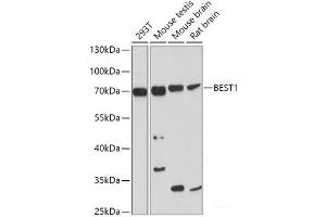 Western blot analysis of extracts of various cell lines using BEST1 Polyclonal Antibody at dilution of 1:1000. (Bestrophin 1 anticorps)