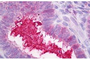 Image no. 1 for anti-Serpin Peptidase Inhibitor, Clade G (C1 Inhibitor), Member 1 (SERPING1) antibody (ABIN1502156)