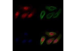 ABIN6265350 and ABIN6266871 staining Hela cells by IF/ICC. (STRADA anticorps  (Internal Region))
