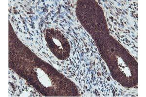Immunohistochemical staining of paraffin-embedded Human endometrium tissue using anti-RUVBL2 mouse monoclonal antibody. (RUVBL2 anticorps  (AA 113-370))