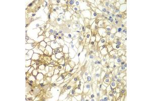 Immunohistochemistry (IHC) image for anti-Syndecan 1 (SDC1) (AA 25-240) antibody (ABIN6215950) (Syndecan 1 anticorps  (AA 25-240))