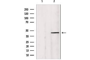 Western blot analysis of extracts from HepG2, using PIAS1 Antibody. (PIAS1 anticorps  (N-Term))