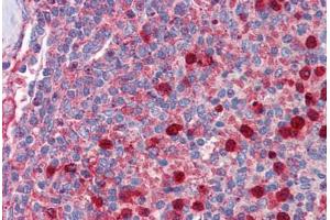 Human Spleen: Formalin-Fixed, Paraffin-Embedded (FFPE)