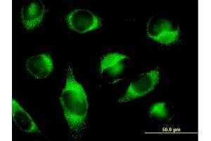 Immunofluorescence of purified MaxPab antibody to PLOD3 on HeLa cell. (PLOD3 anticorps  (AA 1-738))