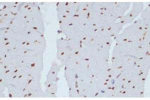 Immunohistochemistry of paraffin-embedded Rat heart using Phospho-CHEK1(S280) Polyclonal Antibody at dilution of 1:100 (40x lens). (CHEK1 anticorps  (pSer280))