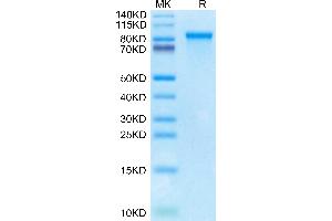 Cynomolgus MMP-9 on Tris-Bis PAGE under reduced condition.