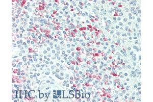 Detection of CDKN2D in Human Spleen Tissue using Polyclonal Antibody to Cyclin Dependent Kinase Inhibitor 2D (CDKN2D)