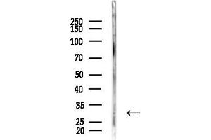anti-Tropomyosin 1 (Alpha) (TPM1) (N-Term) antibody