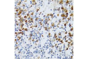Immunohistochemistry of paraffin-embedded human tonsil using p60 C antibody  at dilution of 1:100 (40x lens).
